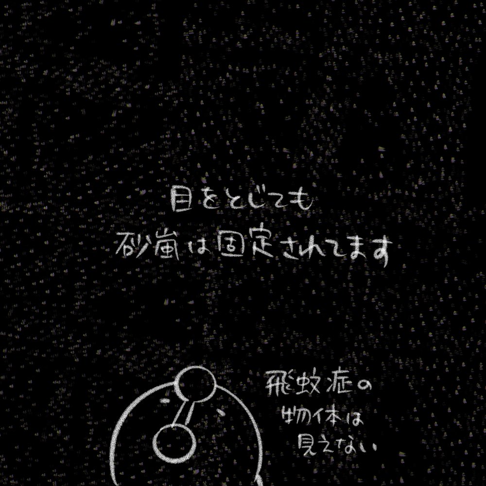 ダーシオ 在 Twitter 上 先日仰天ニュースで知ったビジュアルスノウ 視界砂嵐症候群 雪視症 という症状 白い 雪のように感じていなかったので当てはまるか分かりませんが自分の視界も似たようなものかもしれないと思い絵にしてみました 近視乱視のせいと思ってました ダーシオ 在 Twitter 上 先日仰天ニュースで知ったビジュアルスノウ 視界砂嵐症候群 雪視症 という症状 白い 雪のように感じていなかったので当てはまるか分かりませんが自分の視界も似たようなものかもしれないと思い絵にしてみました 近視乱視のせいと思ってました