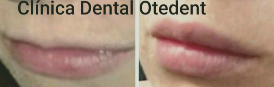 otedent tweet picture