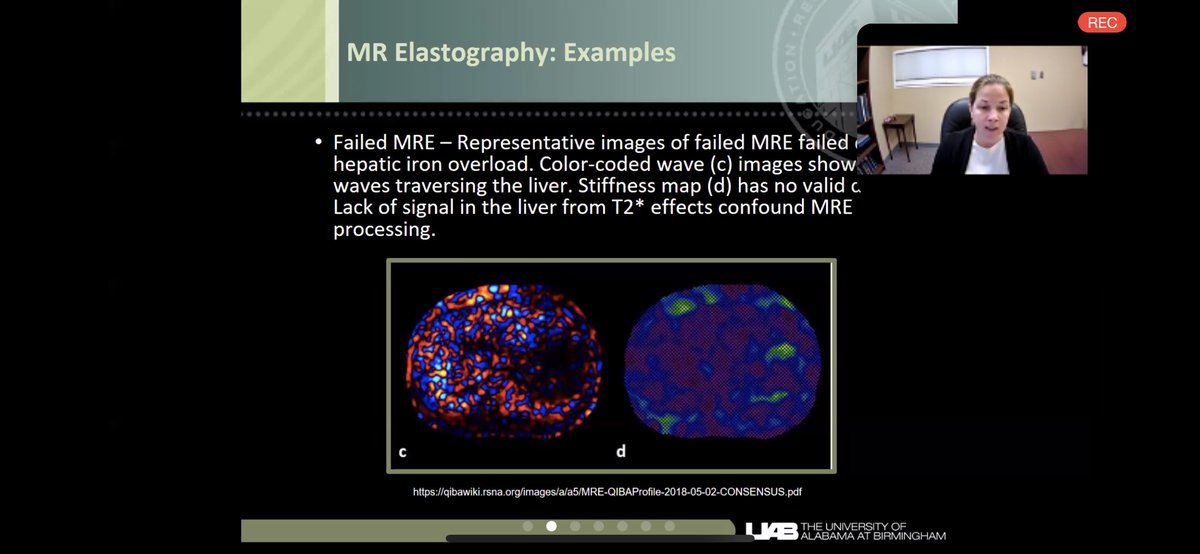 desireemorgan (@desireembham) on Twitter photo Kristin K Porter,MD PhD nailing a great talk on MRE for the UAB GI Update meeting this bright morning! <a href="/uabRadResidents/">UAB Radiology Residency</a> <a href="/UABRadiology/">UAB Radiology</a> <a href="/SamGalgano/">Sam Galgano</a> @KPorterUAB <a href="/CheriCanon/">CheriCanon</a> Kristin K Porter,MD PhD nailing a great talk on MRE for the UAB GI Update meeting this bright morning! <a href="/uabRadResidents/">UAB Radiology Residency</a> <a href="/UABRadiology/">UAB Radiology</a> <a href="/SamGalgano/">Sam Galgano</a> @KPorterUAB <a href="/CheriCanon/">CheriCanon</a>
