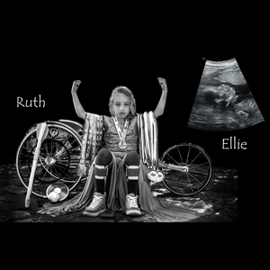 SpinaBifidaNT's tweet photo. Walk-N-Roll for SBANT Today! https://t.co/7lRtSBxAXD https://t.co/hhjGp6JnmZ