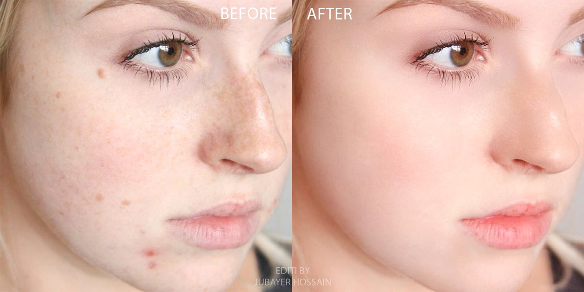 I will do skin retouching and blemish removal work
bit.ly/2DH0eKs
-
#kohlanta #eupgnt #thevoicekids #bvleaks #Freeze #Estelle #NamjoonDay #Diane #Eupen Peter Van de Veire despo #USOpen #EBSBSC #DFBPokal #schlefaz #Moria joonie Flüchtlinge #SaturdayMotivation #lufc #Premi