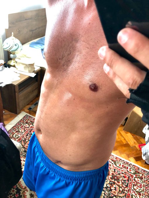 @BigJohnOnlyFans @AaronBurnsXXX Hot guy here for your pleasure 🔞 Cum and let&rsquo;s have some fun🍆💦 https://t<a class="tags" target="_blank" title="On Twitter" href="/?out=eyJ0eXAiOiJKV1QiLCJhbGciOiJIUzUxMiJ9.eyJpYXQiOjE3MjQ5OTI2NzYsImlzcyI6InR3cG9ybnN0YXJzLmNvbSIsIm5iZiI6MTcyNDk5MjY3NiwiZXhwIjoxNzU2NTI4Njc2LCJyZWRpcmVjdF91cmwiOiJodHRwczovL3R3aXR0ZXIuY29tL0JpZ0pvaG5Pbmx5RmFucyJ9.tycrjt0kSFTXJxpOinZfl8GlfElZ1JOh_XBpNapK5ATMYs9DdF5jSV4tgUYEUFFczLI1VyznSOUjM2DKMskbRA">@BigJohnOnlyFans</a><a class="tags" target="_blank" title="On Twitter" href="/?out=eyJ0eXAiOiJKV1QiLCJhbGciOiJIUzUxMiJ9.eyJpYXQiOjE3MjQ5OTI2NzYsImlzcyI6InR3cG9ybnN0YXJzLmNvbSIsIm5iZiI6MTcyNDk5MjY3NiwiZXhwIjoxNzU2NTI4Njc2LCJyZWRpcmVjdF91cmwiOiJodHRwczovL3R3aXR0ZXIuY29tL0Fhcm9uQnVybnNYWFgifQ.aqakKxchTunETVr8O1A0r35PARlE9dtvHO4JlHmK_fOlh2TiYCpYVYVNfSnsSIPkABsDKWdQBBkSYYOLz8k8Kw">@AaronBurnsXXX</a><a href="/tag/underarmour"class="tags"><span>#underarmour</span></a>