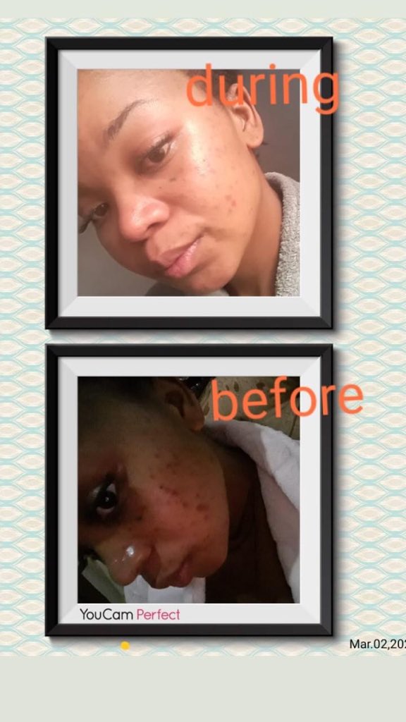 WeAfricanButter's tweet photo. #ToWhomItMayConcern  AfricanButter Ess is a skin correction cosmetic that breads results. It’s made from natural oils that feed the skin with good nutrition proving natural skin glow and we would love to work with @Clicks_SA #MTNBusinessHack #clickschallenge https://t.co/ZfvA2Vhxel