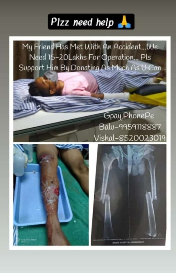 SahooSwetanshu's tweet photo. #SaveShiva
@KTRTRS @RaoKavitha @Eatala_Rajender @ArogyaTelangana @TelanganaCMO @TelanganaHealth https://t.co/LFXKWbBlvb
Every penny counts .Retweet and donate and pray for his speedy recovery 🙏🙏 https://t.co/eBt5qSJzfs