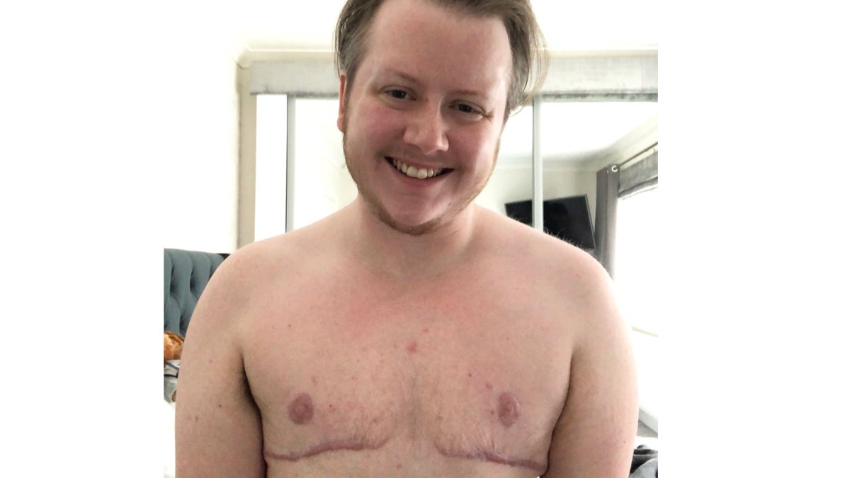 Been debating whether to be “out” during my time at medical school, but visibility is important.

So hi. I’m Ethan. I’m trans. I’m one year post top surgery today. Full post is on insta.

#MedTwitter #MedStudentTwitter #GayMedTwitter #TransMedTwitter #QueerMedTwitter #TransInSTEM