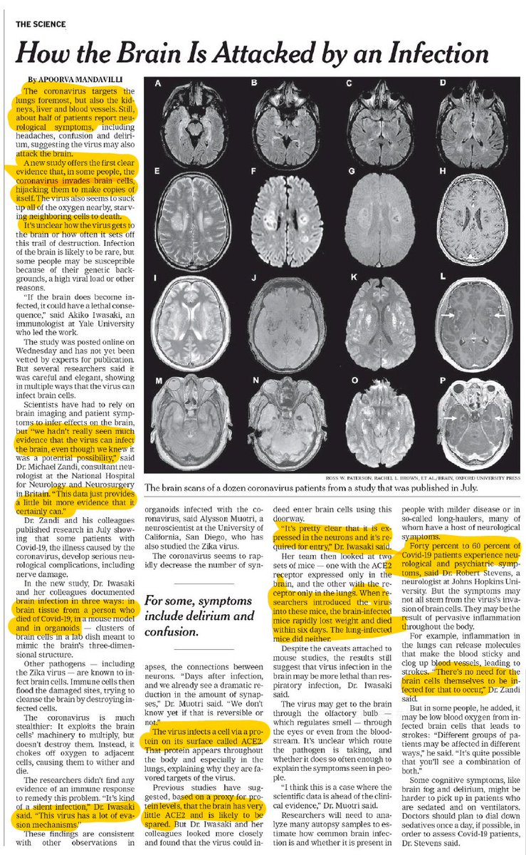 6. The important study was summarized and translated by  @apoorva_nyc  @NYTScience  https://www.nytimes.com/2020/09/09/health/coronavirus-brain.html?searchResultPosition=1