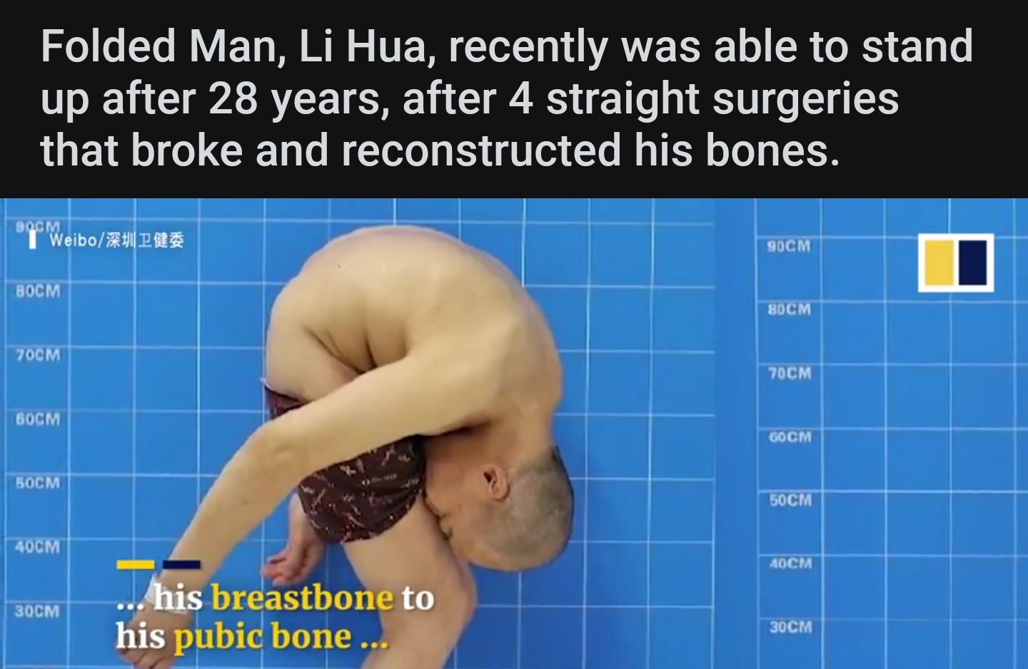 ＧＥＮＥＲＡＬ ＳＡＭ on X: Dude went and got surgery after God gifted him the  ability to suck his own cock t.coyY0XVOWBUm  X