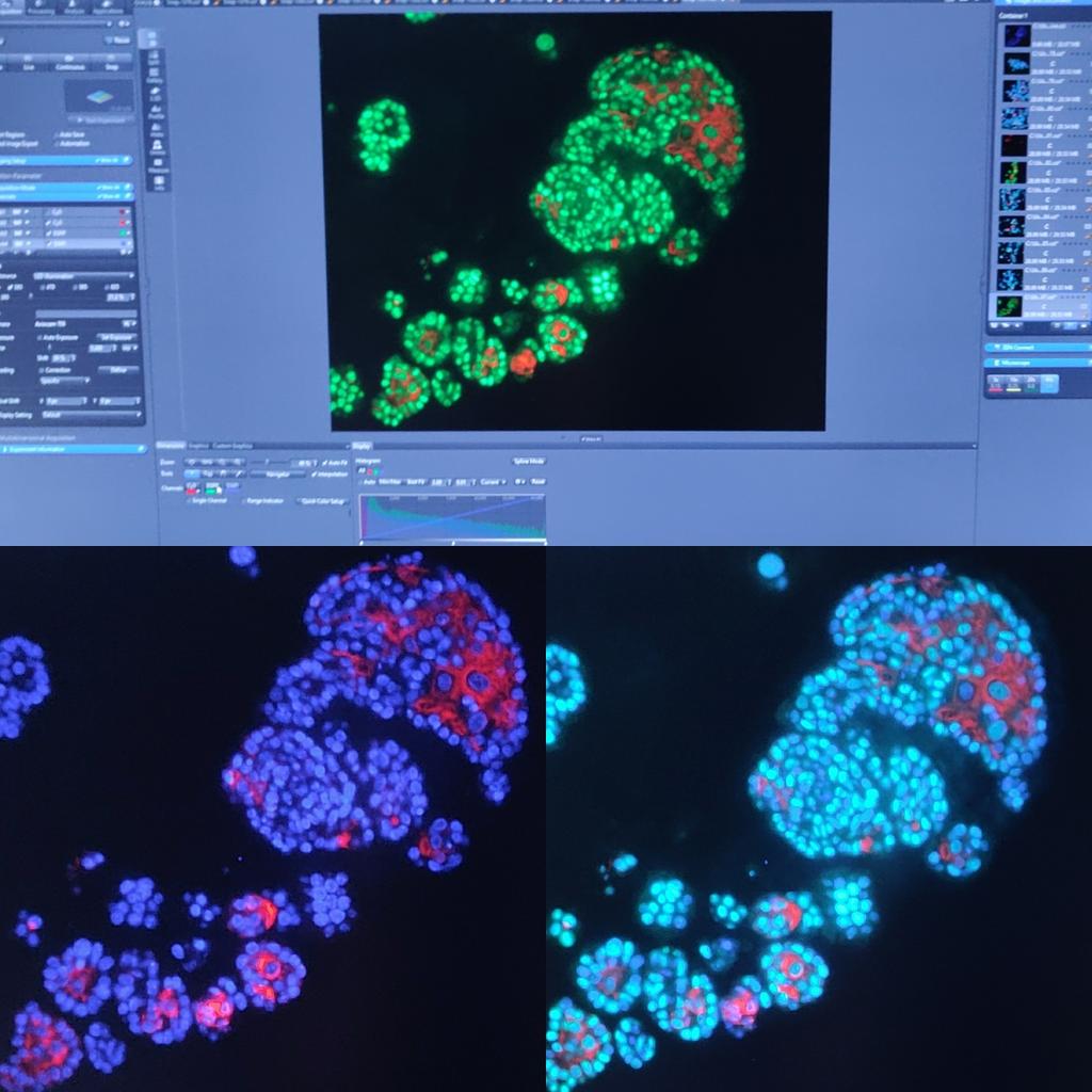 jldchn's tweet photo. Saturday artwork ! #cellbiology #zenblue #organoid #axioscope https://t.co/9n58dimDHV
