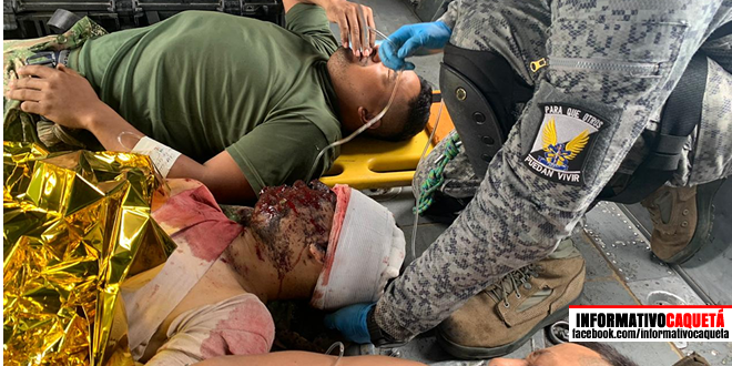 InformaCaqueta's tweet photo. Un suboficial y dos soldados profesionales orgánicos de la Fuerza de Despliegue Rápido N.º 1, resultaron heridos producto de una acción terrorista perpetrada por la Estructura Séptima del Grupo Armado Organizado Residual.
#InformativoCaquetá #EJERCOL https://t.co/7GUqyBibvb