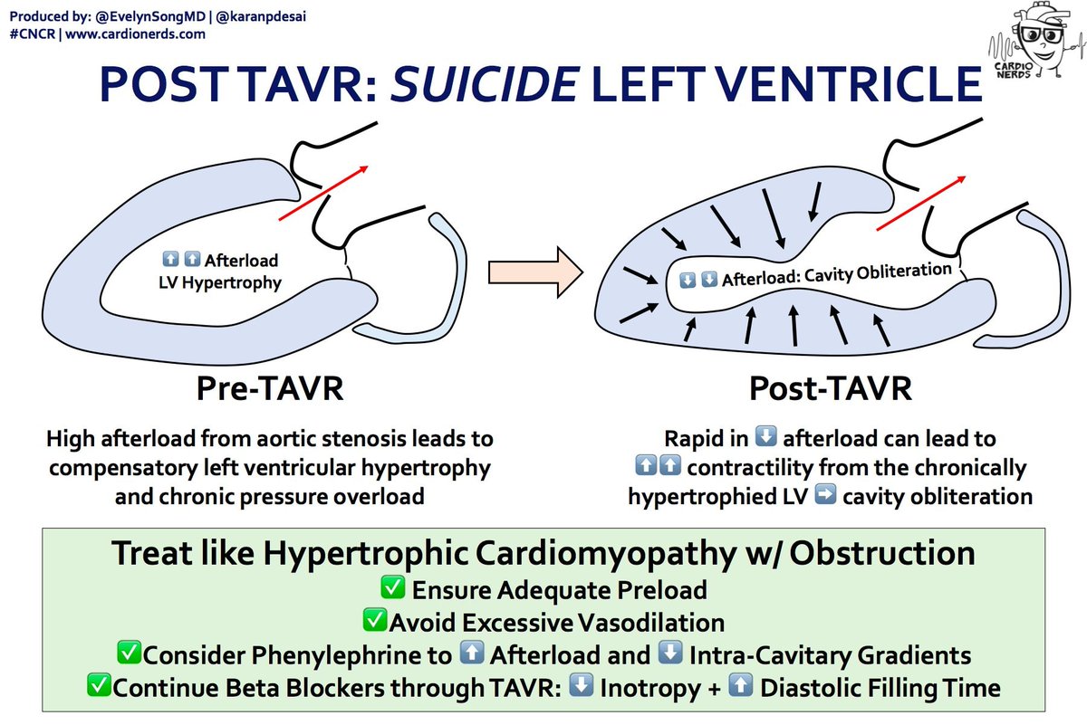 Rare but Important condition to recognize in TAVR world;
-----
Management of Suicidal LV after #TAVR is similar to that of HOCM: 
⬆️preload with IVF 
⬆️afterload – phenylephrine is the pressor of choice 
🚫inotropes and consider treating with neg inotropes such as BB/CCB