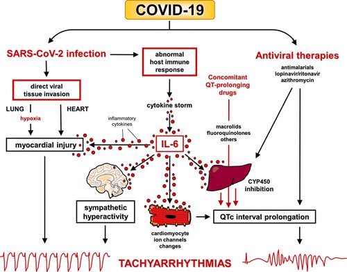 Bgheyath's tweet photo. Covid-19 and proposed mechanisms of arrhythmia. Great and relevant read ! #cardiotwitter https://t.co/AaZ8IsGvNc. 2020;142:7–9 https://t.co/D30GDotlCa