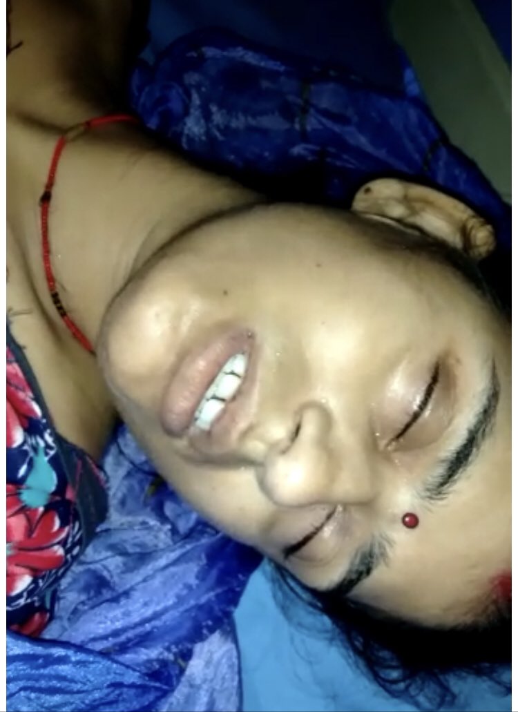 erpawanindia's tweet photo. @firozabadpolice @myogiadityanath @Uppolice @dgpup @agrapolice @PMOIndia @HMOIndia प��ड़ित जीवन मृत्यु के बीच लड़ रही रही है, कल रात्रि १२ बजे से अभी तक @firozabadpolice व @agrapolice द्वारा मेडिकल नहीं कराया गया । ऐसा क्यूँ ? 
यदि पीड़ित की मृत्यु हो जाती है तो इसकी पूरी ज़िम्मेदारी SHO टुंडला व फ़िरोज़ाबाद की होगी । FIR SHO टुंडला के ऊपर दर्ज की जाएगी । https://t.co/RySq0L88bd