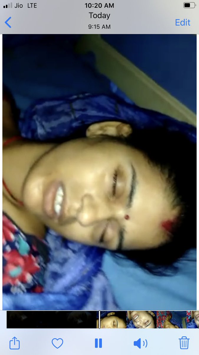 erpawanindia's tweet photo. @firozabadpolice @myogiadityanath @Uppolice @dgpup @agrapolice @PMOIndia @HMOIndia प��ड़ित जीवन मृत्यु के बीच लड़ रही रही है, कल रात्रि १२ बजे से अभी तक @firozabadpolice व @agrapolice द्वारा मेडिकल नहीं कराया गया । ऐसा क्यूँ ? 
यदि पीड़ित की मृत्यु हो जाती है तो इसकी पूरी ज़िम्मेदारी SHO टुंडला व फ़िरोज़ाबाद की होगी । FIR SHO टुंडला के ऊपर दर्ज की जाएगी । https://t.co/RySq0L88bd