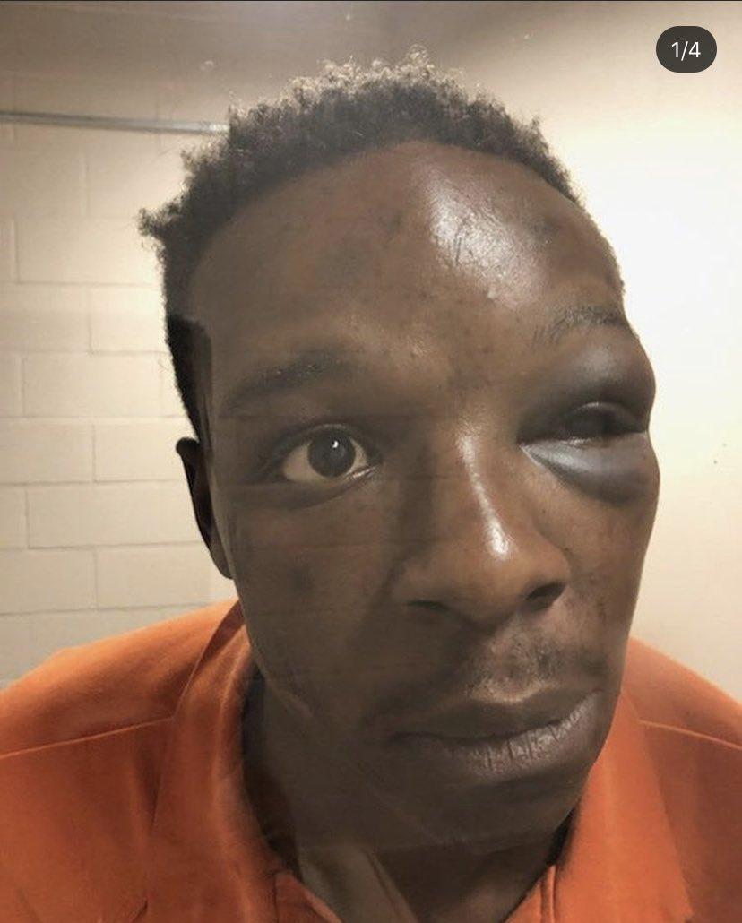 Patrick_TAA's tweet photo. Shameful!

#RoderickWalker #PoliceBrutality #UniversalROE #21stCenturyPolicing @ClaytonCountySO https://t.co/6prGUZlkSU