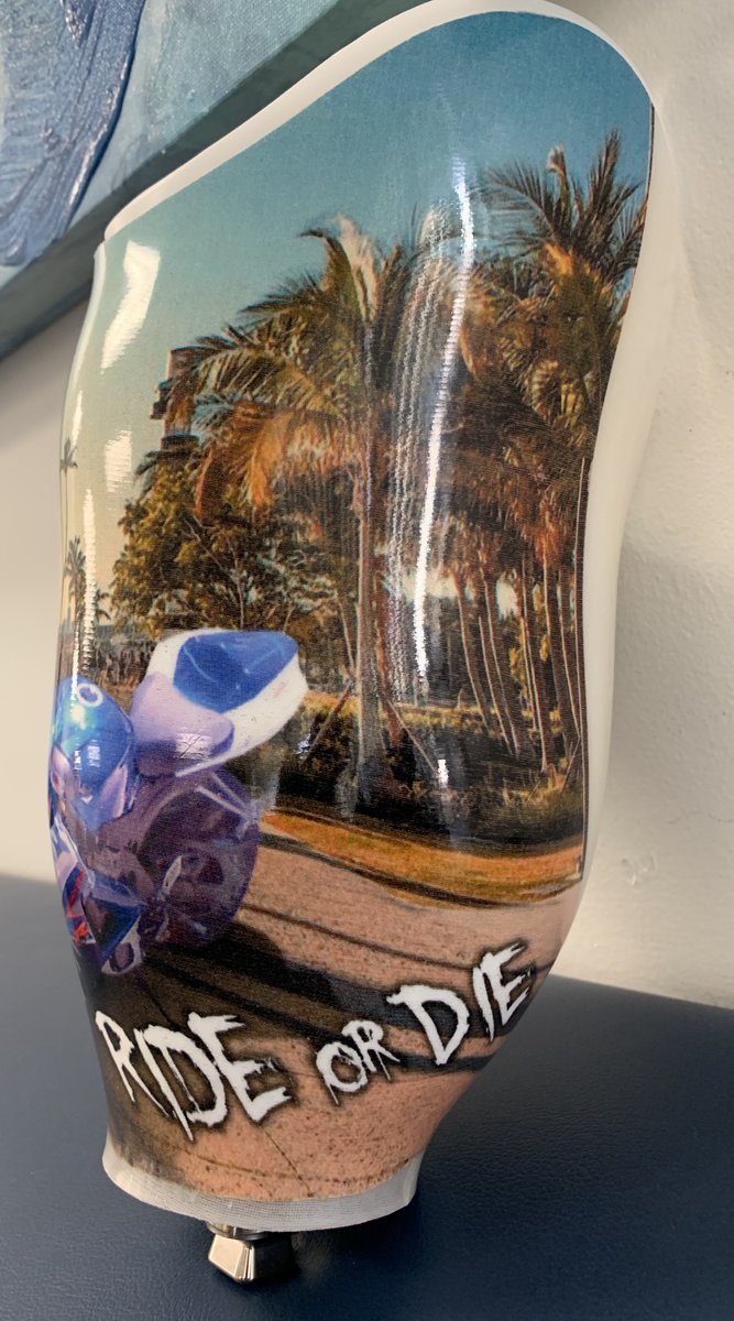 Our Patient in Ft Lauderdale, FL asked if it would be possible to have his actual motorcycle on his socket. 
Yes.  Yes you can.  And yes we did!  Great job by our OPC team making his socket so unique.  We are happy that you love it!  
#SocketSunday #WeAreOPC #IamOPC #WearItProud