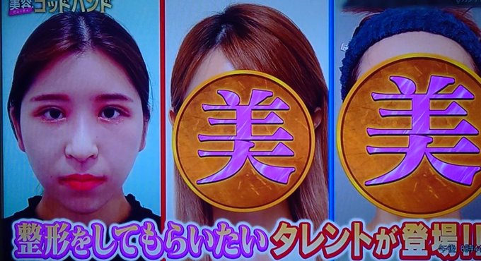 美容ゴッドハンド 整形で韓流アイドルの顔にした女性の整形後の顔に視聴者騒然 え 500万かけてこれかよ まとめダネ