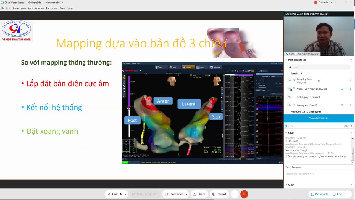 AnhNguyenMrMax1's tweet photo. The 4th basic #EPFoundation was successfully conducted on Fri 11th Sept Topic of PVC with #3DMapping. Thanks to Dr. Hung and Dr. Tuan from Hanoi Heart for bringing 3D PVC mapping - advanced tech in EP
Next Fri - Topic of non-fluoro mapping and ablation.
#3Dmapping #abbottproud https://t.co/AIfTnKGglO