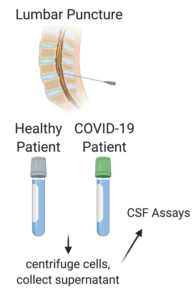 We were fortunate to have patient volunteers who allowed us to use some extra clinical lumbar puncture samples to study COVID-19 related neuroinflammation. 3/n