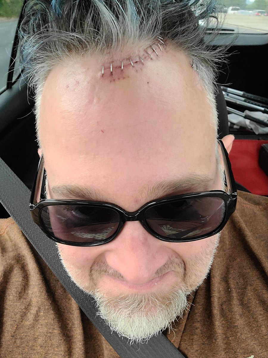 Knightfire5513's tweet photo. Just got home after #brainsurgery , been a crazy few weeks in the hosp. #Mentalhealth , but been waiting on this Surgery for years to happen. Fingers Crossed it helps, damn totally forgot to see if #Intel or #AMD  would sponsor this and upgrade my Brain while in there! lol, https://t.co/oJat4oQdPy