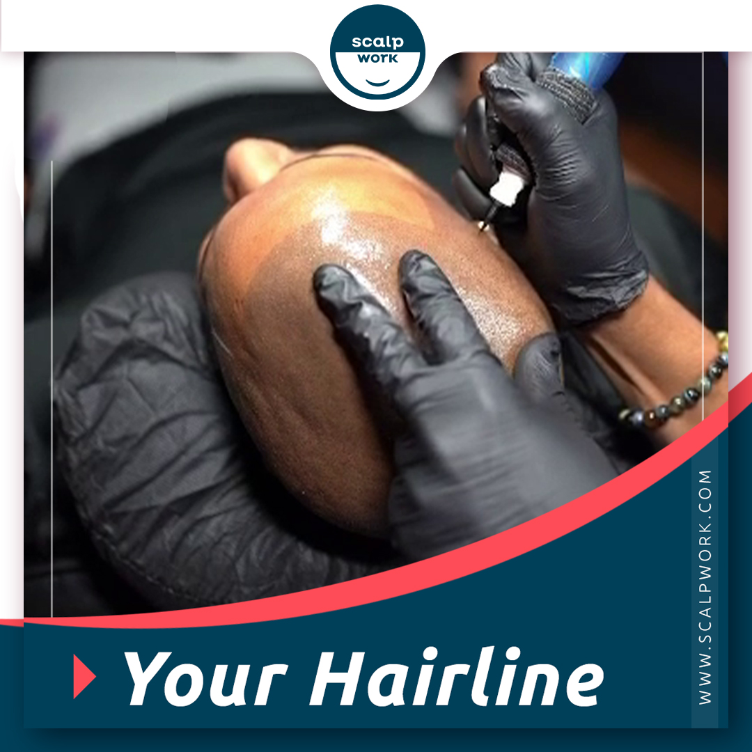 RenBarberShop's tweet photo. It's the first thing you see, or don't see. Allow us to re-create your hairline with SMP.

https://t.co/M1aGfW4suW

#barbershop #hairline #men #fashion #yourlook https://t.co/PhiMsgARIq