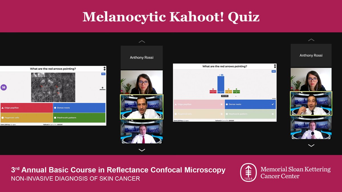 We hope you enjoyed the Melanocytic Kahoot! Quiz! Thank you <a href="/KLiopyris/">KonstantinosLiopyris</a>, Cristian Navarrete, MD., and Jilliana Monnier, MD for hosting a fun educational session for the attendees of our #MSKconfocalCME course! Congratulations to the winners! Stay tuned for two more quizzes!