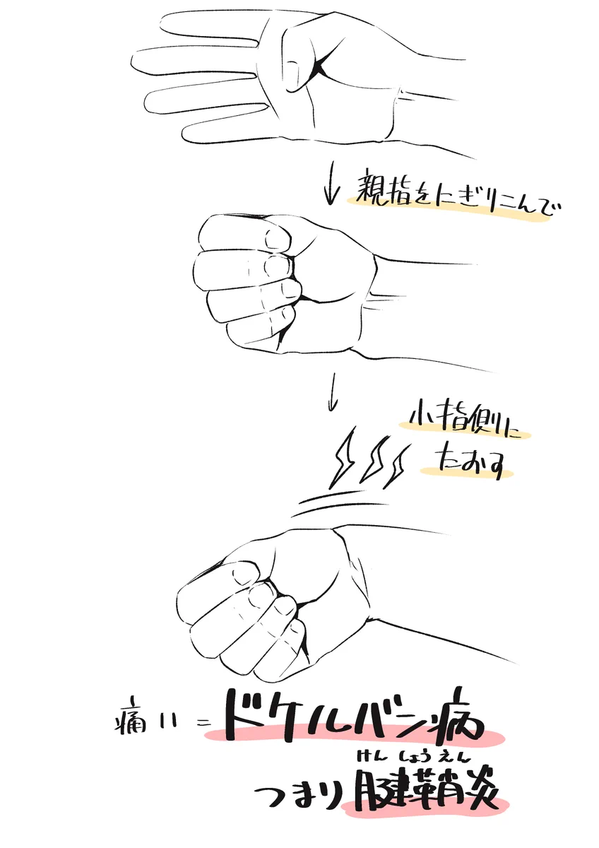 気になる痛みがある人は試してみると良いかも？腱鞘炎のセルフチェック方法！
