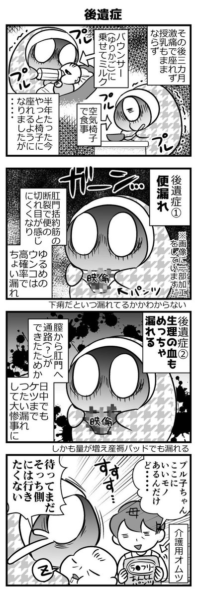 【4コマ】出産したらケツまで裂けた話('・ω・`)つ 