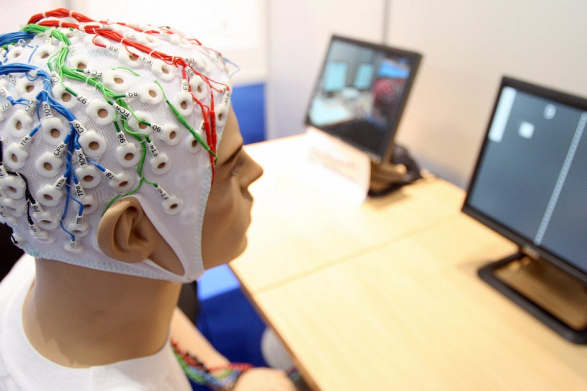 Исследование головы. Ультразвуковая допплерография (уздг). Как называется исследование головы. Как называется исследование головы. Как называется исследование головы.