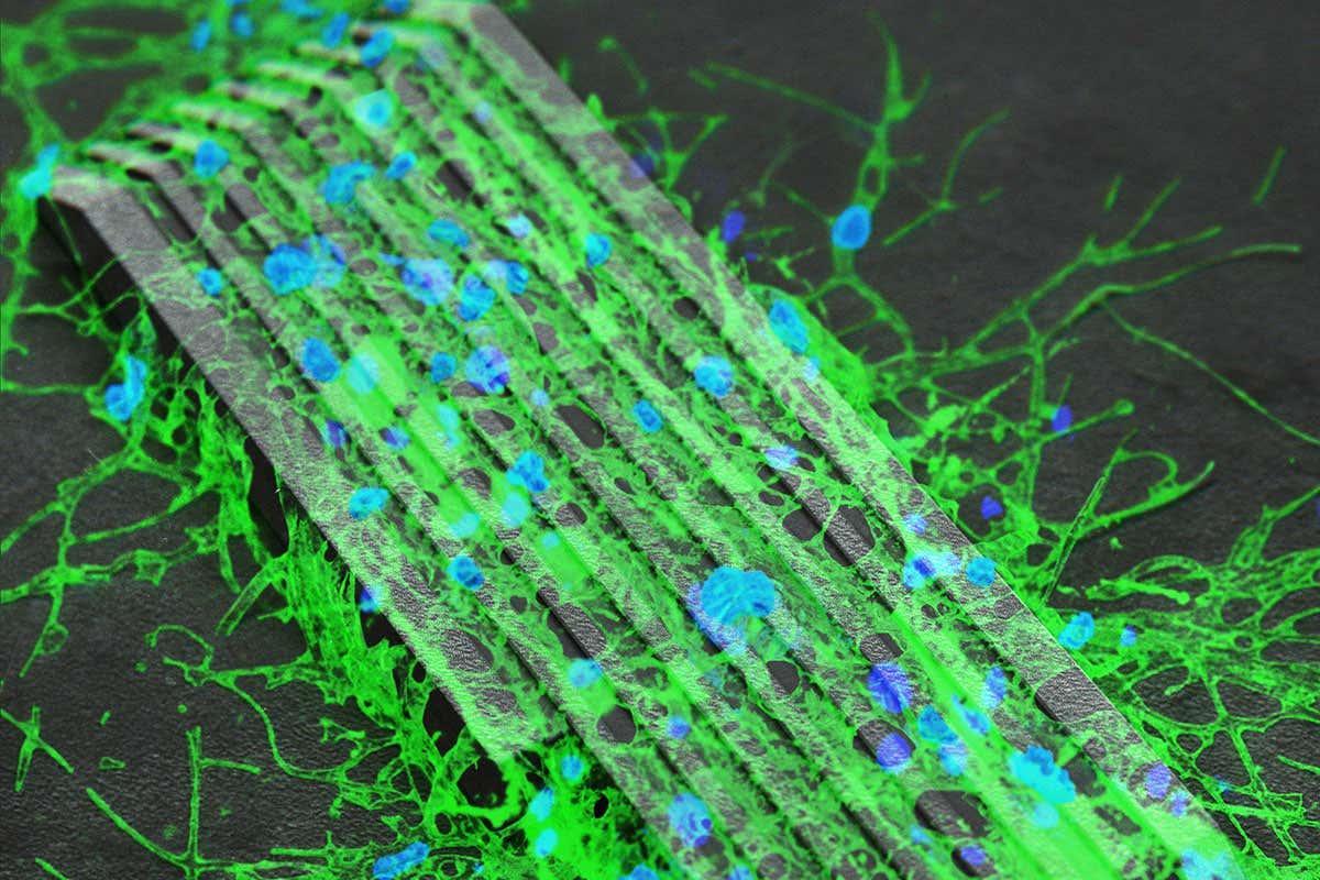 Magnetic microbots can hook up brain cells to make a neural network bit.ly/2RYJSA7