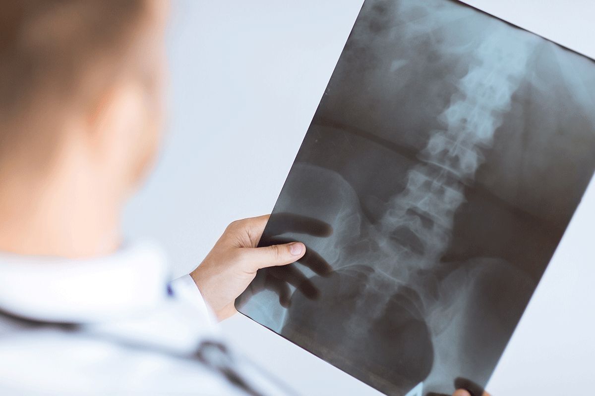 GreenImagingUS's tweet photo. All About Myelograms -  https://t.co/58d8sIH2rw #Myelograms #diagnosticimaging #GreenImaging #spine #spinehealth https://t.co/Ua47eDtzy5