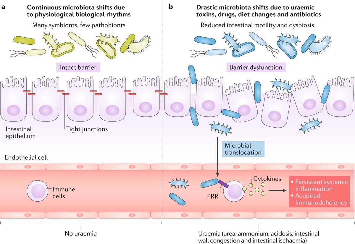 Nature Reviews Nephrology (@natrevneph) on Twitter photo Effects of #CKD-associated changes in intestinal flora on intestinal barrier integrity and immunological fitness from our Review on the intestinal microbiome and fitness in kidney disease by Björn Meijers, Pieter Evenepoel & <a href="/hjanders_hans/">Hans-Joachim Anders</a> go.nature.com/2NgOMcx Effects of #CKD-associated changes in intestinal flora on intestinal barrier integrity and immunological fitness from our Review on the intestinal microbiome and fitness in kidney disease by Björn Meijers, Pieter Evenepoel & <a href="/hjanders_hans/">Hans-Joachim Anders</a> go.nature.com/2NgOMcx