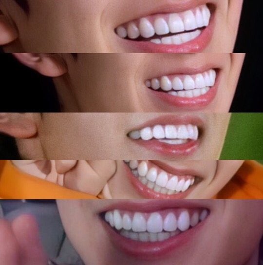 heeseung’s shining white teeth 