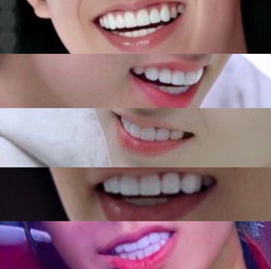 heeseung’s shining white teeth 