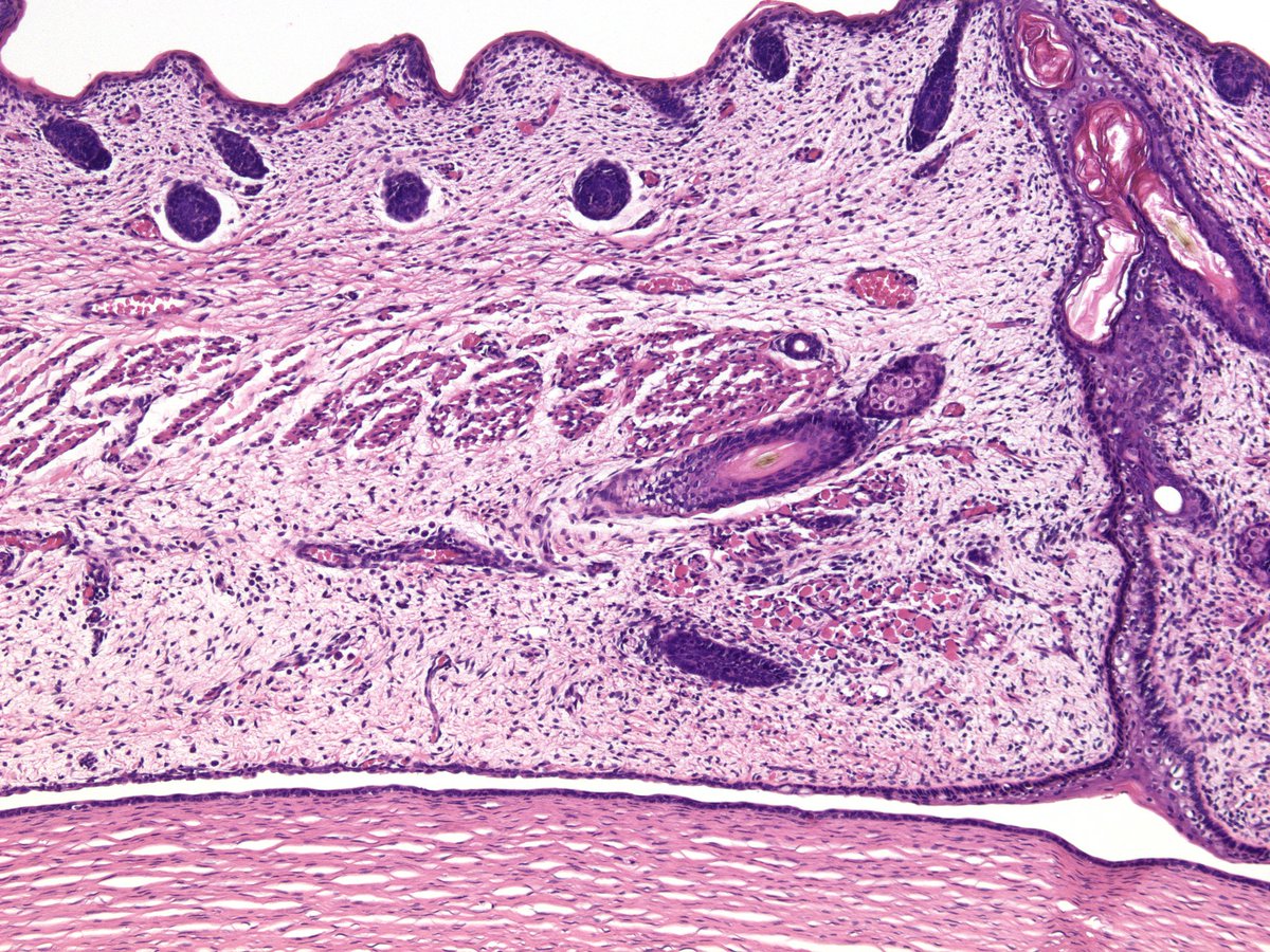 18 week gestational age fetus. The eyelid development with early adnexal appendages, early Meibomian gland ducts. The upper and lower eyelids are still fused together, just about ready to separate. Note the absence of Bowman layer in the underlying developing cornea.