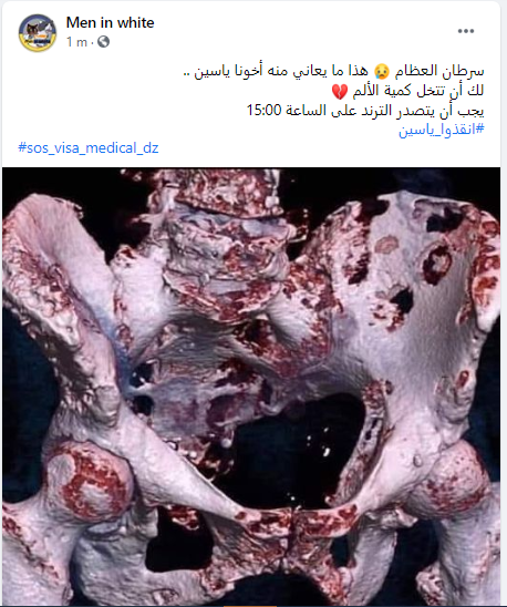 miw_dz's tweet photo. #انقذوا_ياسين 
#sos_visa_medical_dz https://t.co/jrk9iRnxbS