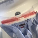 ワイシャツの襟に漂白剤をかけたら何故か真っ赤に？!原因は意外なあれだった!