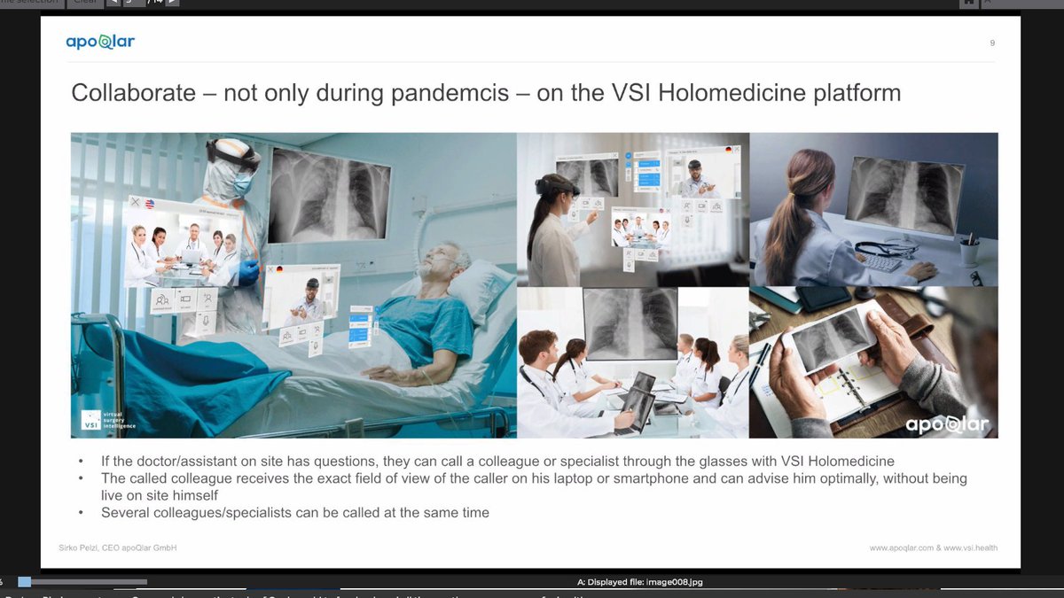 16/  @ApoQlar showed a number of different ways in which augmented reality makes a lot of sense in a medical context to overlay spatial visualizations and data visualizations in a hands-free way. There's already a lot of monitors that are radiating information.