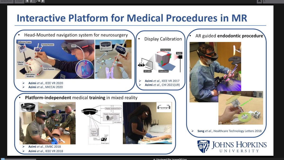 18/ Johns Hopkins University's  @AzimiEhsan talked about "SurgeonMR: Interactive Platform for Surgical Procedures in Mixed Reality"