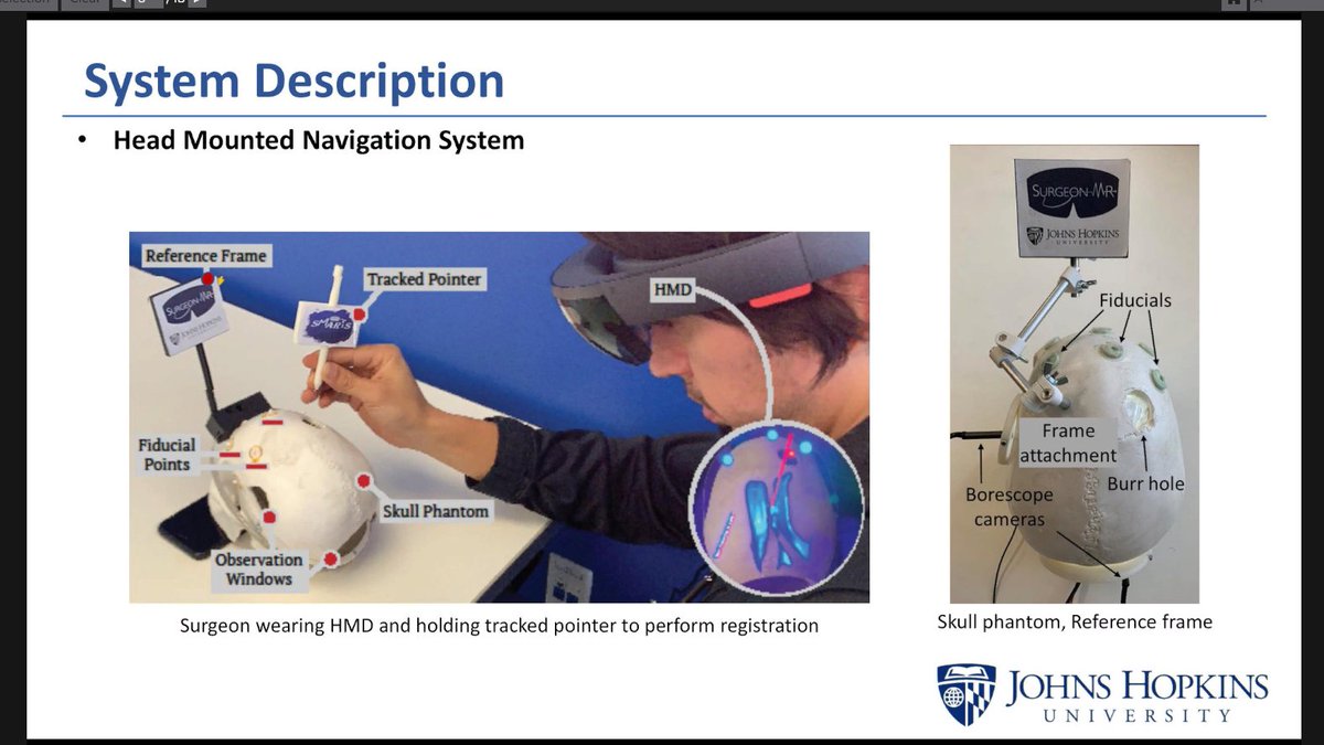 19/  @AzimiEhsan showed how SurgeonMR is being used in a training, guidance, & visualization for the registration, planning, & insertion of a catheter.