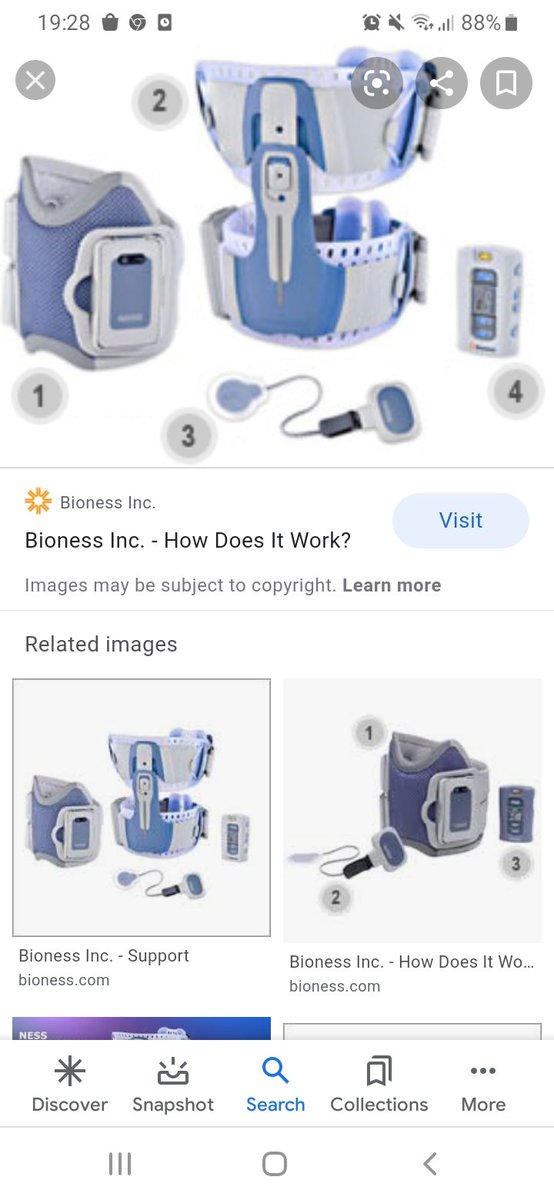 shiftms's tweet photo. I ve been yesterday to try the second part of my electronic device stimulation for droop foot. Is anybody else wearing this? I use to love it, but after 2 years, it start to work less. Anybody else can give me some hints on this, pls? #letsfightmstogether #mspower #msrobocop https://t.co/tu1dKlD5jJ