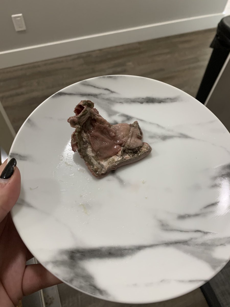 megvank's tweet photo. @Sunrype can you please tell me what this is? I found it at the bottom of one of your carton of juices. This is concerning and the public should know what it is. Thanks! https://t.co/Vyqbx8ySx7