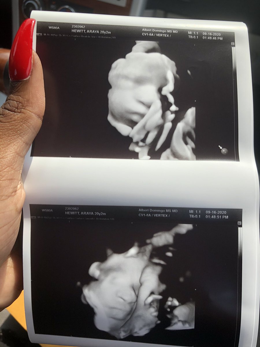 rayaaaa___'s tweet image. #MylilRyder 👩‍👧💕