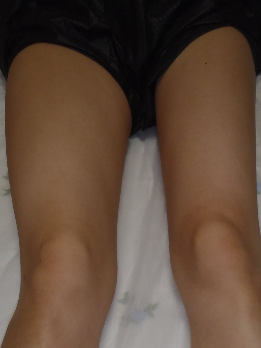 痩身 脚やせエステサロン Ulysses Ullysses初回はhot Pepperが断然お得です 2回目以降はメンバー会員になって頂くのがお得ですが 皆様生活スタイルがございますので 2回目以降もhot Pepperでご来院される方もいらっしゃいます T Co