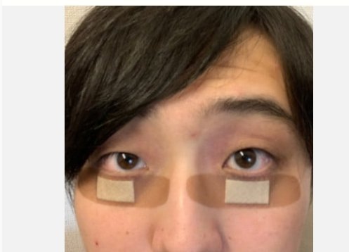 上原恵理 私を癒してくれる広告達 絆創膏はブーム とうとう目の下のクマにまで絆創膏が貼られましたよ