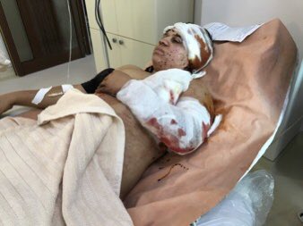 Pictures of Armenians injured in today's intense clashes with Azerbaijan