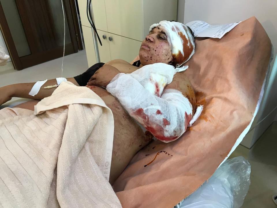 armgov's tweet photo. In #Stepanakert alone, more than 10 people were injured, including children and women. 

Только в Степанакерте пострадало более 10 человек, в том числе дети и женщины. 

@ArtsakhOmbuds @Artak_Beglaryan 
#ArtsakhStrong #NKpeace https://t.co/LBxRQJJhyY