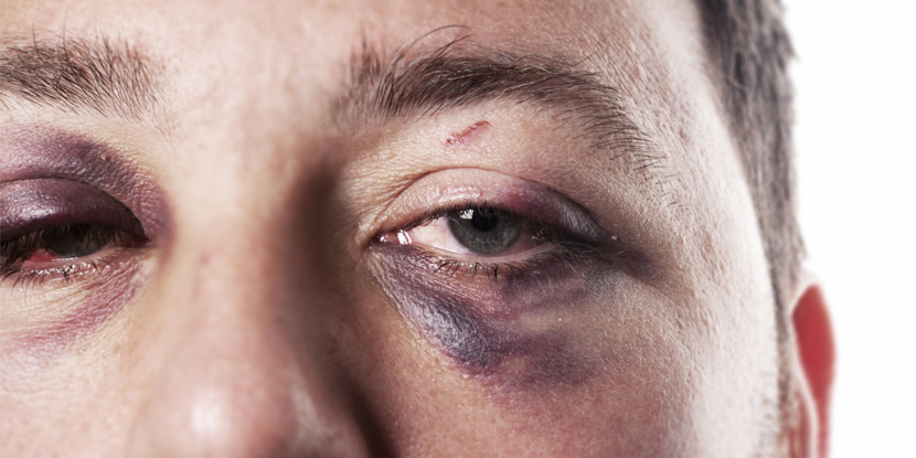 joseluissariego's tweet photo. 1/10 Cuando se habla de #ViolenciaDeGénero suele pensarse sólo en mujeres, pero existe otro tipo de #ViolenciaDeGenero, la que sufren los hombres por el hecho de ser hombres.
Abro hilo ⬇️ https://t.co/8WUPmqFlUC