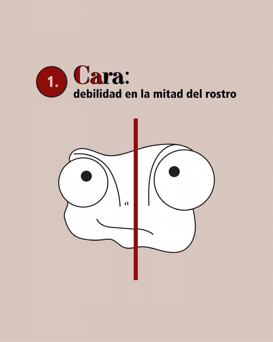drdargaray's tweet photo. CAra
Debilidad en la cara. Se puede notar claramente en el video del Dr. Jon Paul. https://t.co/gpK2H014WC