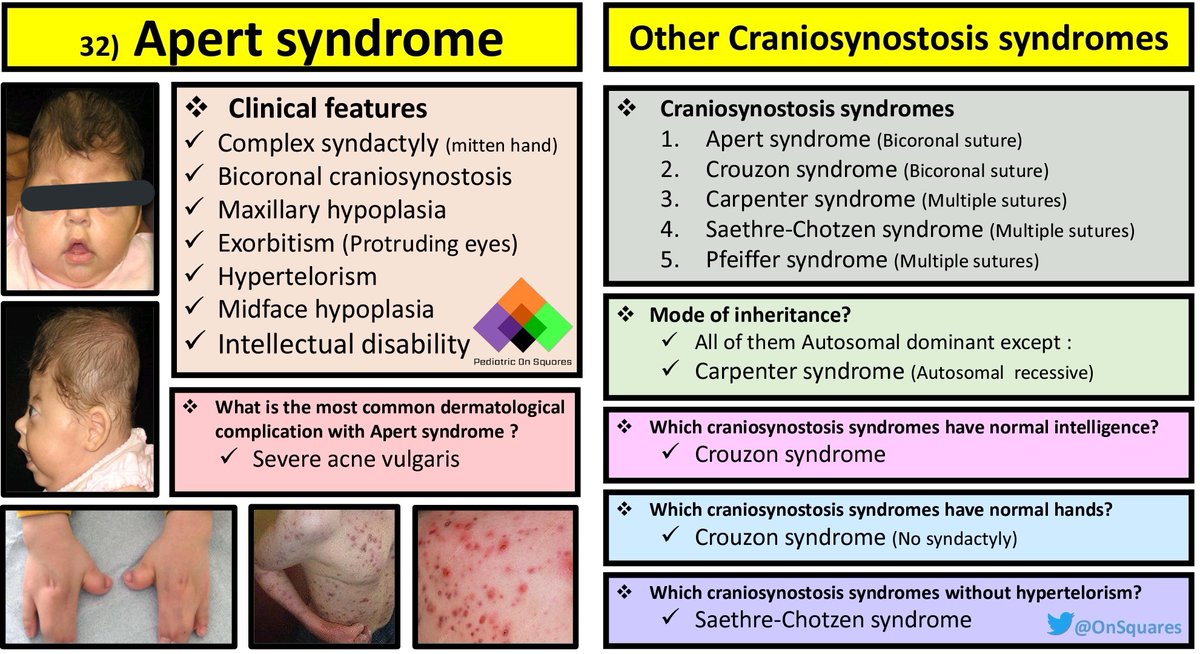 OnSquares's tweet photo. Summary of Apert syndrome and other Craniosynostosis syndromes

#Pediatric #Genetics https://t.co/g6iz40VcCY