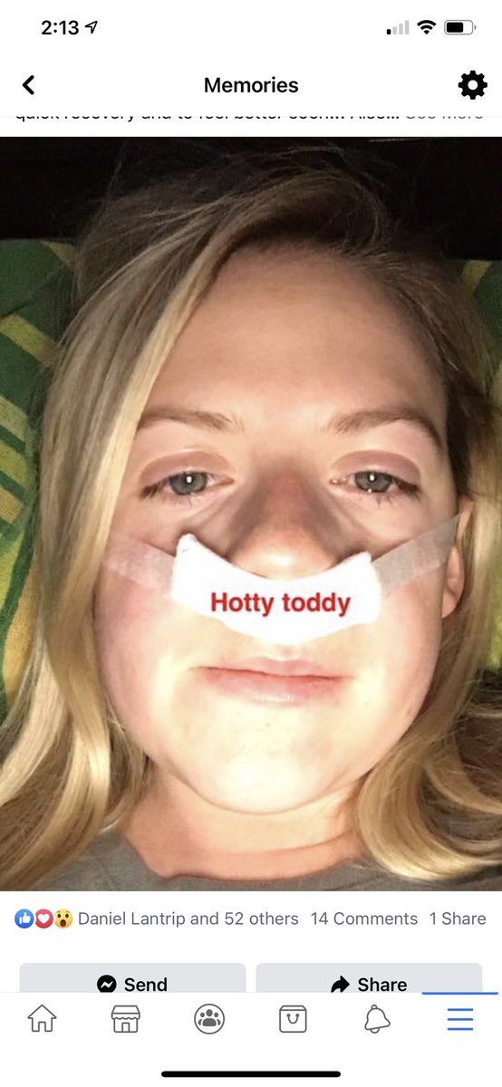 maykay_mk's tweet photo. 4 years ago after sinus surgery....why am I so weird 😂🤦🏼‍♀️ But like Hotty Toddy anyway..... https://t.co/OYv2SJ9EiF